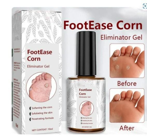 Feet Corn Removal Serum 30ml ( Pack Of 1 ) - amazino