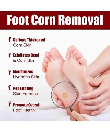 Feet Corn Removal Serum 30ml ( Pack Of 1 ) - amazino