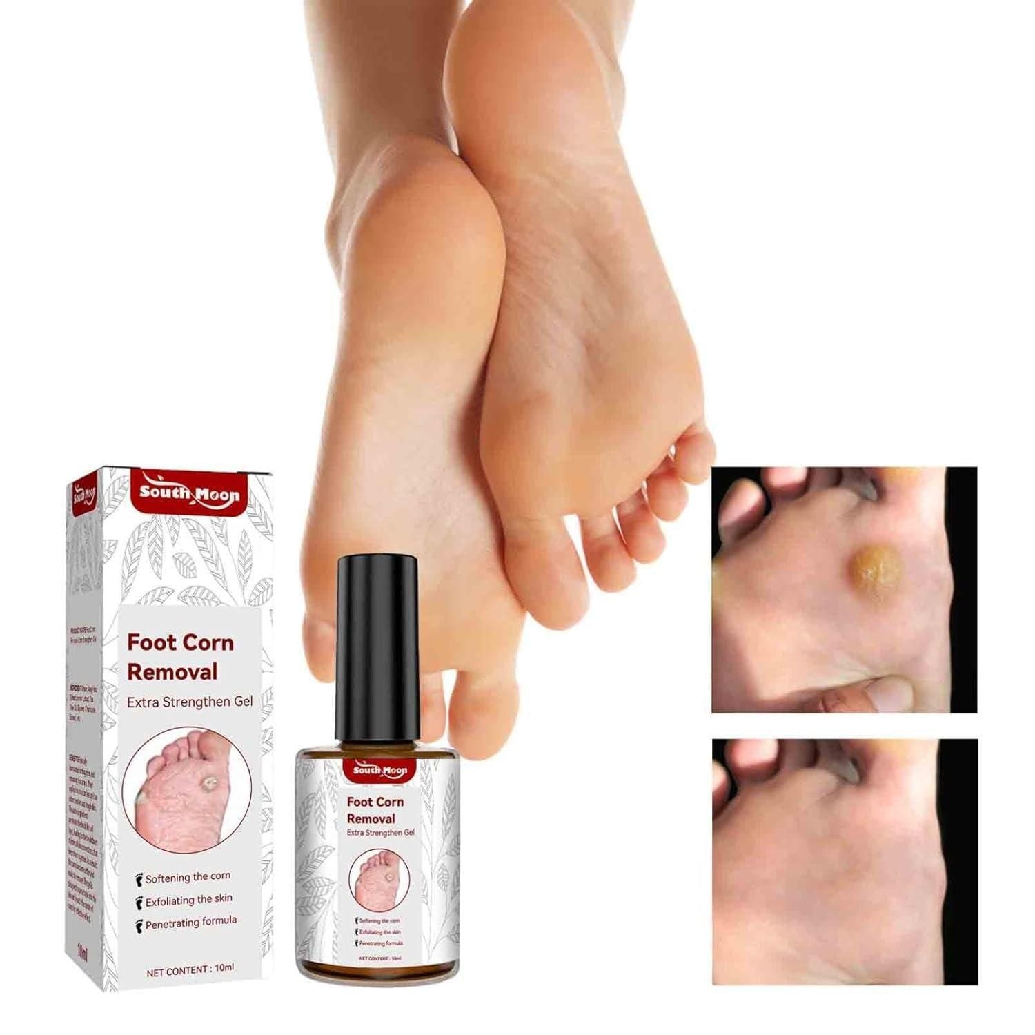 Feet Corn Removal Serum 30ml ( Pack Of 1 ) - amazino